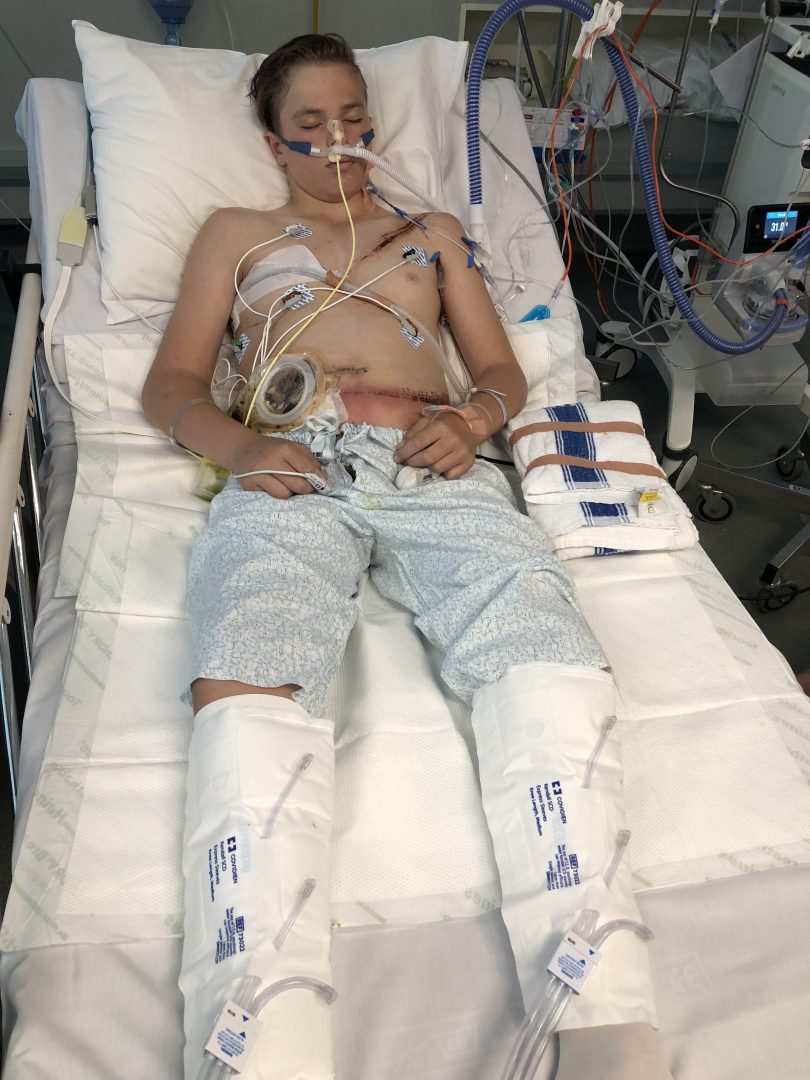 TJ Campagna lying in ICU bed at Canberra Hospital.