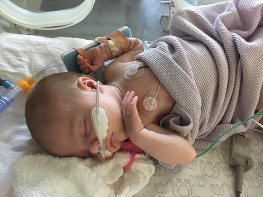 baby with RSV on oxygen